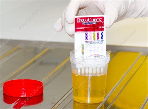 squirt bottle drug test|Urine drug tests: Uses, procedure, detection times, and results.